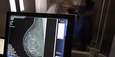 Entidades alertam médicos sobre pedidos de mamografia digital