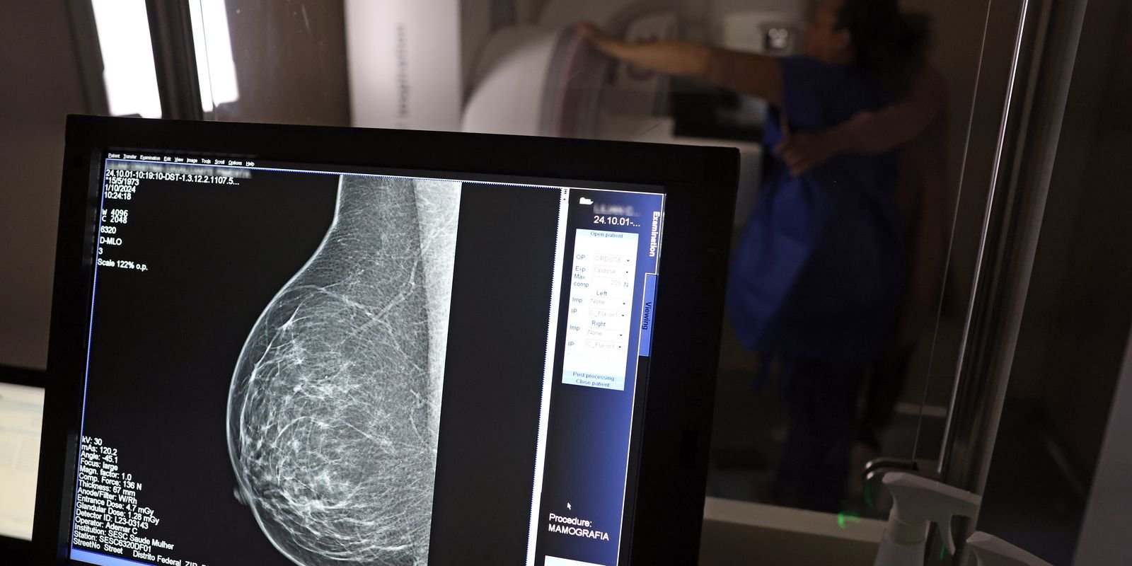 Entidades alertam médicos sobre pedidos de mamografia digital